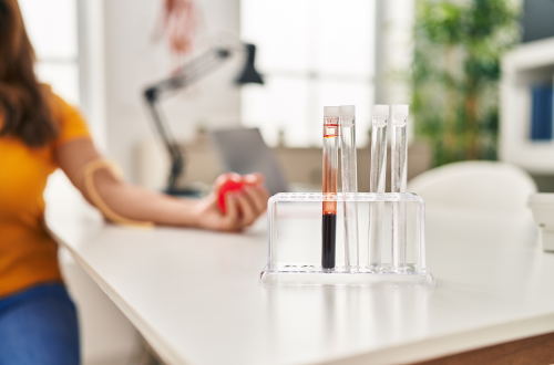 Healthcare Made Simple: The Rise of At-Home Laboratory Services